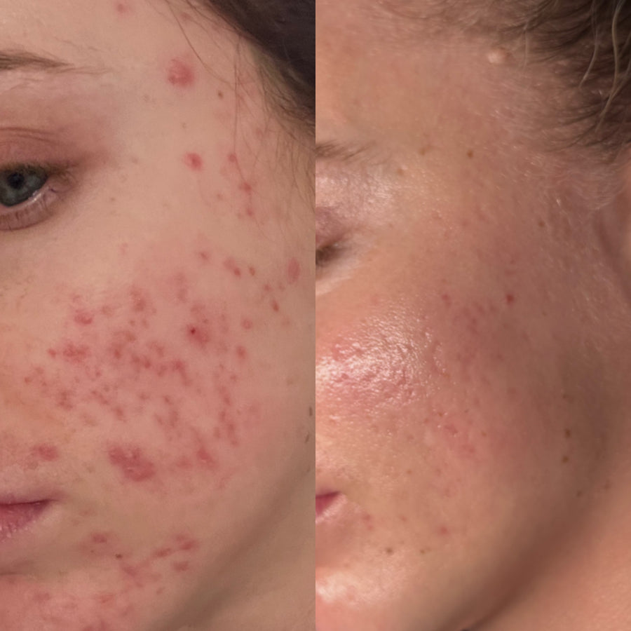 Skin File 08