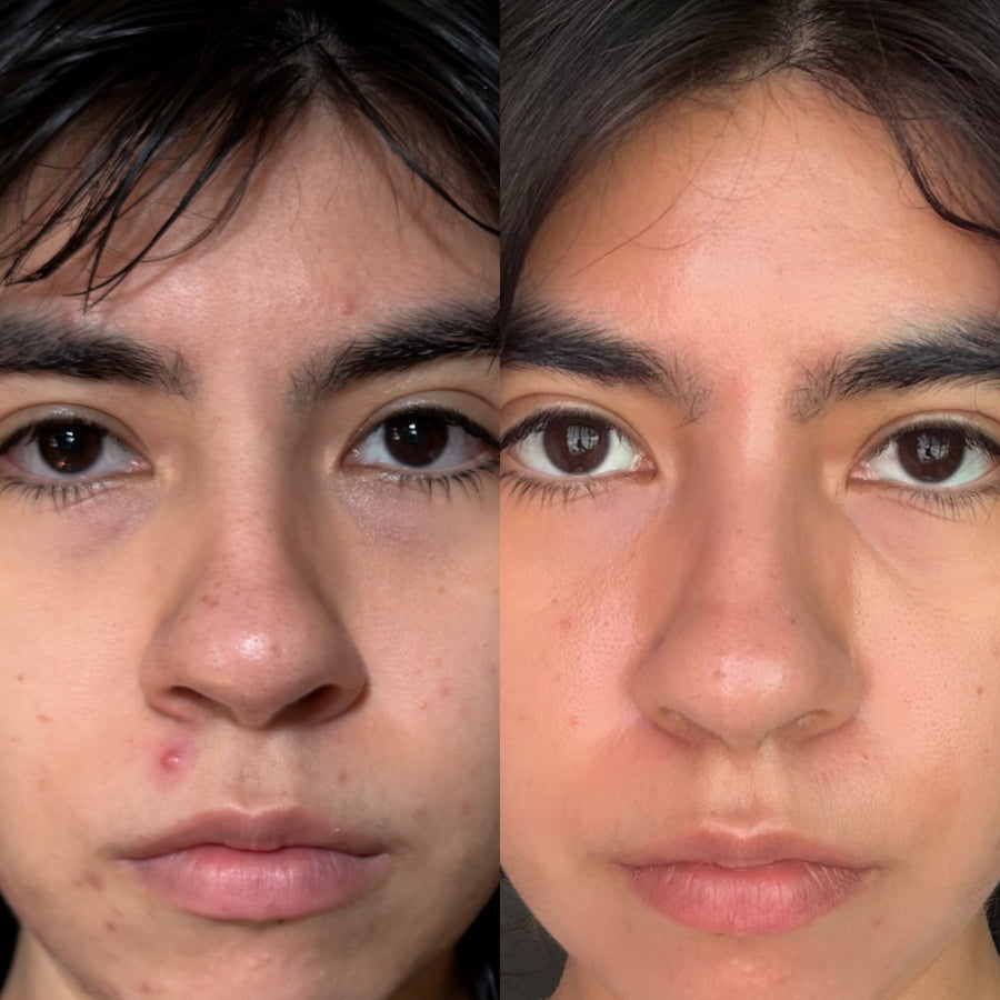 Skin File 11