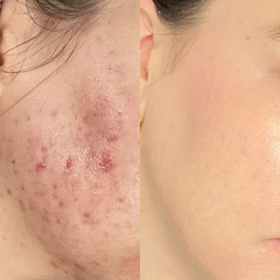 Skin File 15