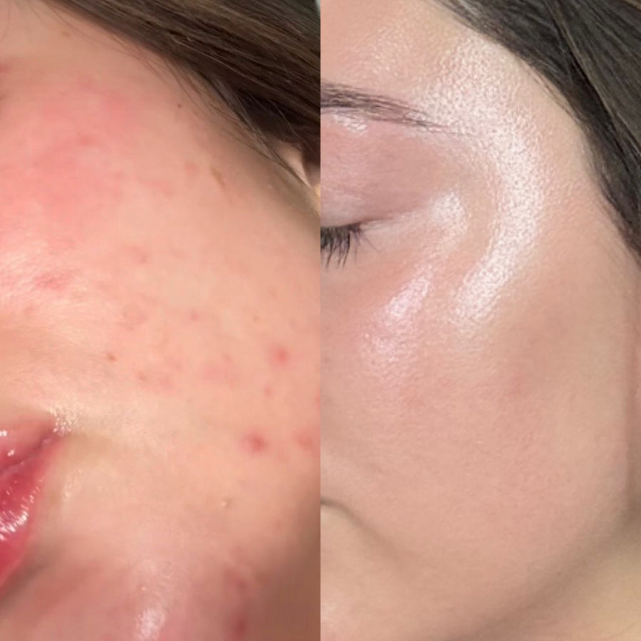 Skin File 05