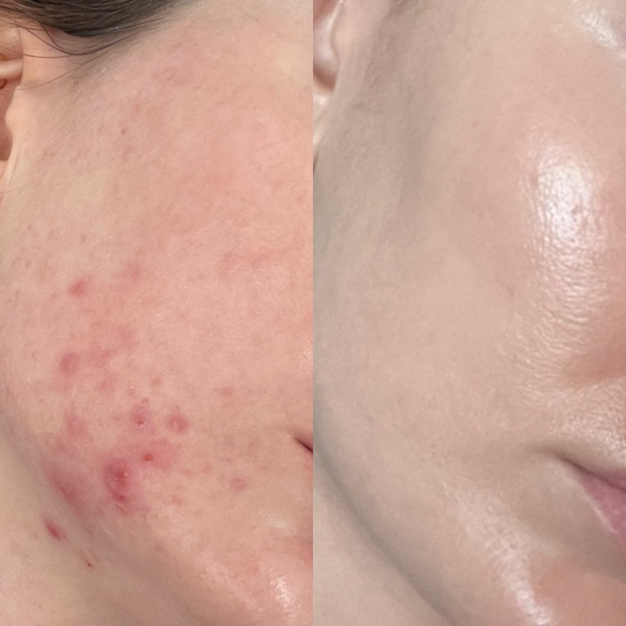 Skin File 02